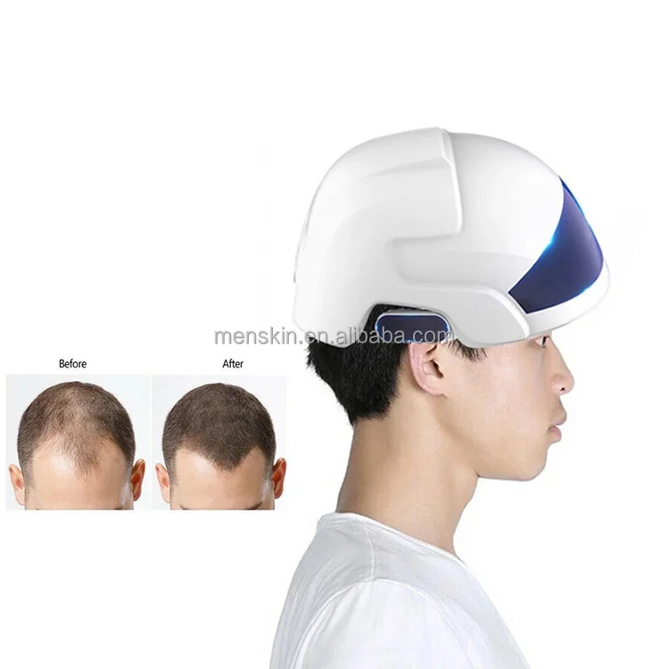 

Factory price 650 nm Laser hair Hair regrowth laser hair growth helmet