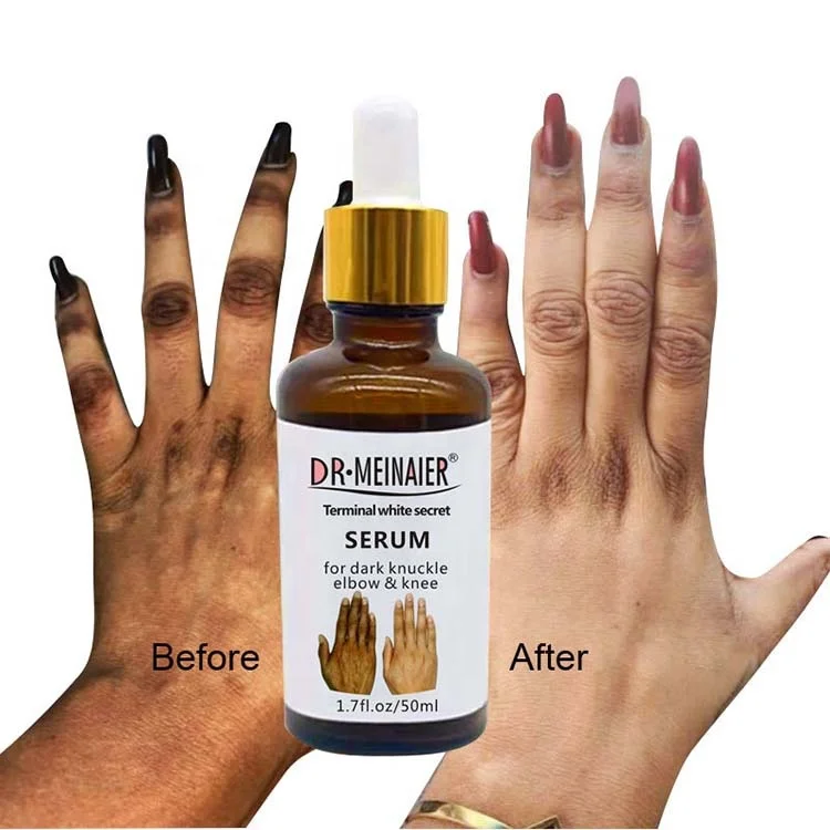 

Private Label Foot Hand Knuckle Eraser Skin Whitening Serum Removing Dark Knuckles Serum For Elbow Knee