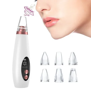 

Personal microdermabrasion pimple removal machine black spots comedone vacuum blackhead pore suction extractor, White/customized