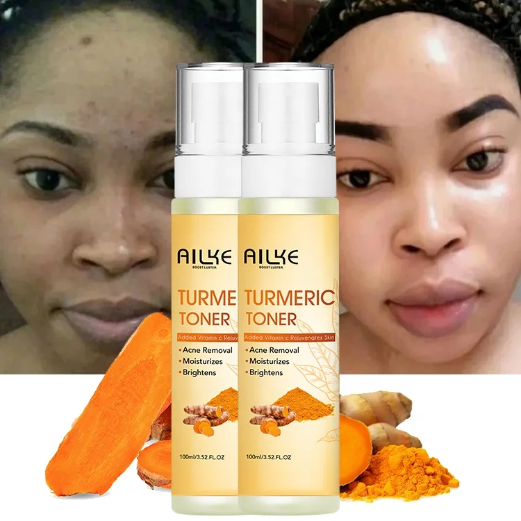 

OEM/ODM Natural Brightening Turmeric Face Toner Spray Anti Acne Skin Toner for Face