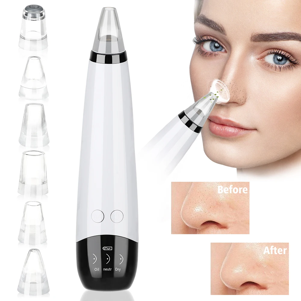 

JOSUNN 2021 Factory Price Skin Care Nose Pore Cleaning Facial Comedo Acne Pimple Black Spot Blackhead Remover Vacuum