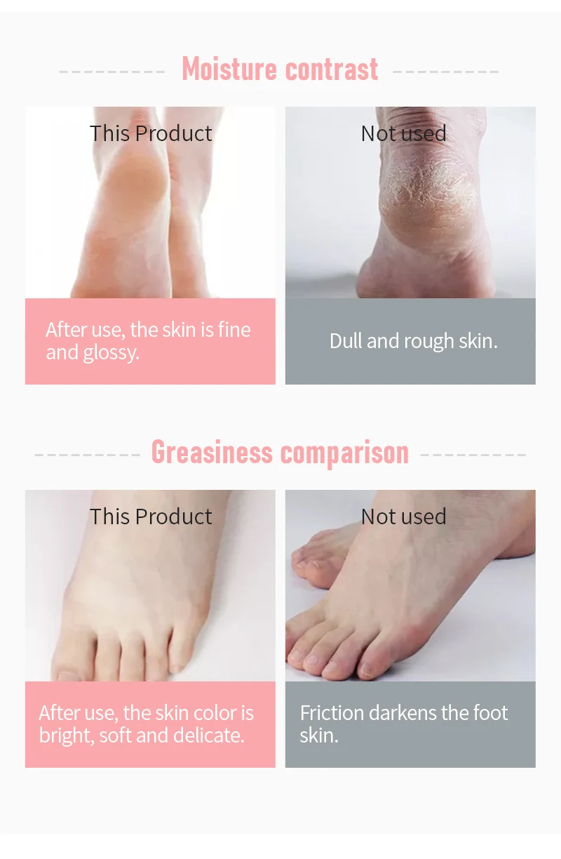 OEM private label Urea 15% Urea Luxury Foot Cream Baby Like Feet Moisturizing Nutrition Soften Cutin Anti-cracking Foot Cream