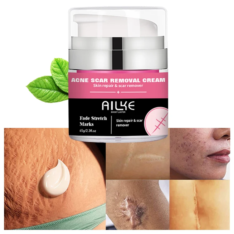 

AILKE Skin Care Burn Scar Removal Repair Gel Face Pimples Acne Scar Mark Removal Cream For Old Scars On Legs