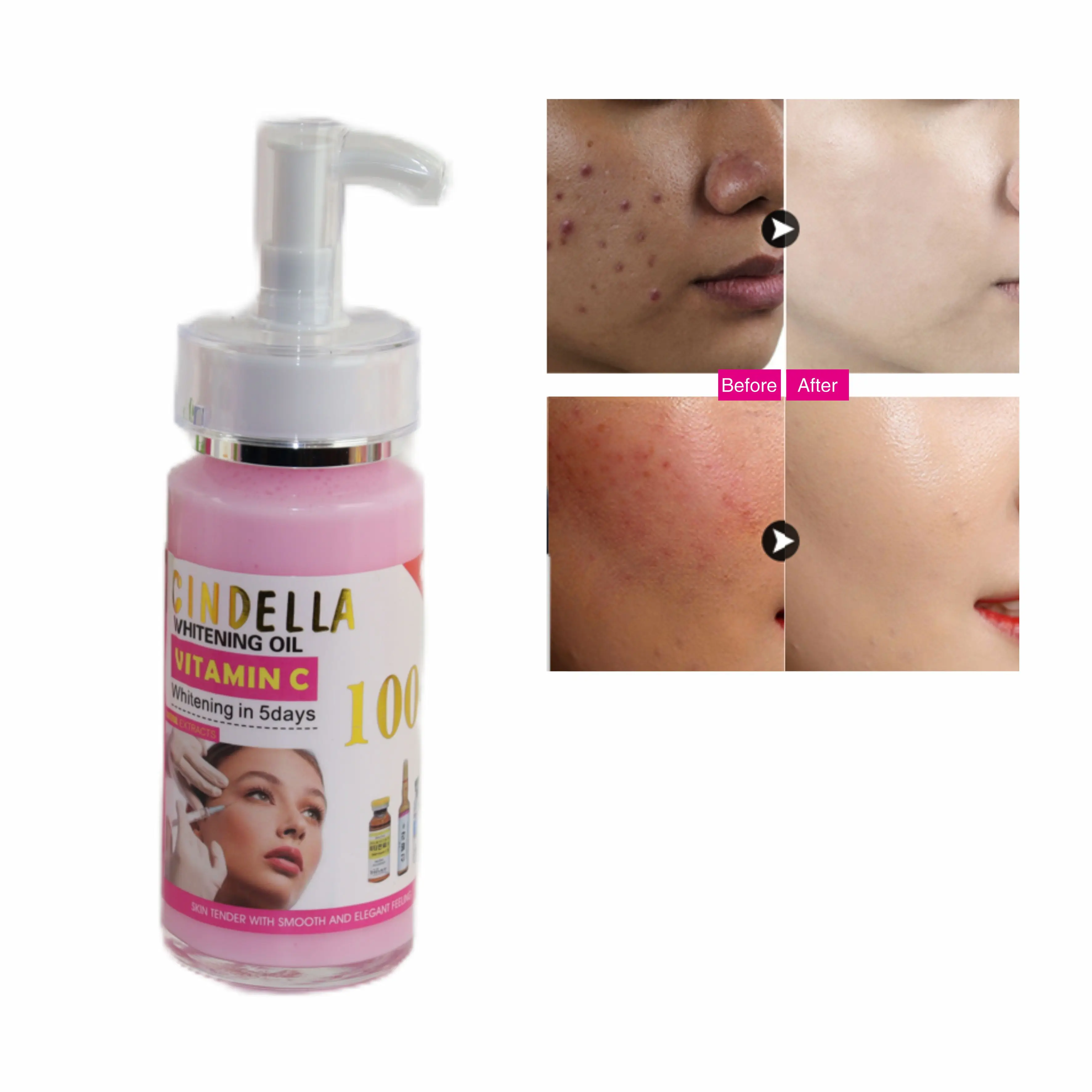 

Korea Oem Skin Care Serum White Secret Acne Scars Remover Dark Spots Freckle Refining Whitening-Serum Form Liquid