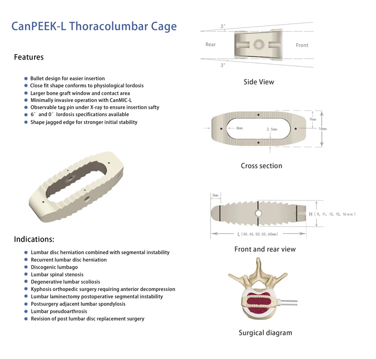 Spine Lateral Lumbar Cage for OLIF DLIF Cage