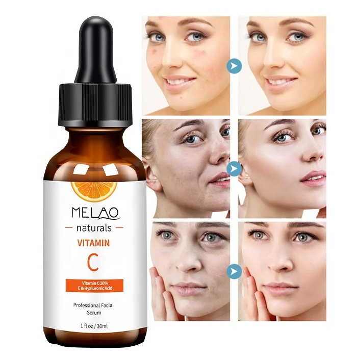 

30ml Private Label Natural Organic Beauty Facial Skin Care Whitening Moisturizing 20% Vitamin C Serum For Face