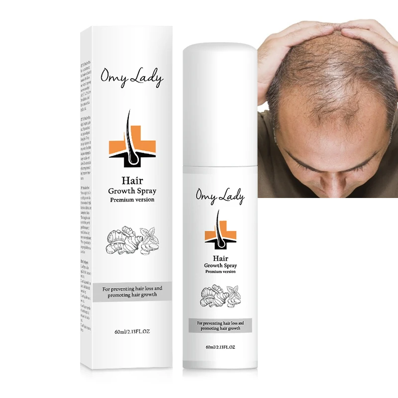 

Balala omy lady Anti hair loss 60ml best hair growth tonic spray ginger extract enriched