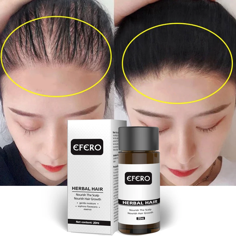 

Powerful serum for hair growth prevents hair loss thicker essential oil to prevent hairgrowth Anti-Hair Loss Serum