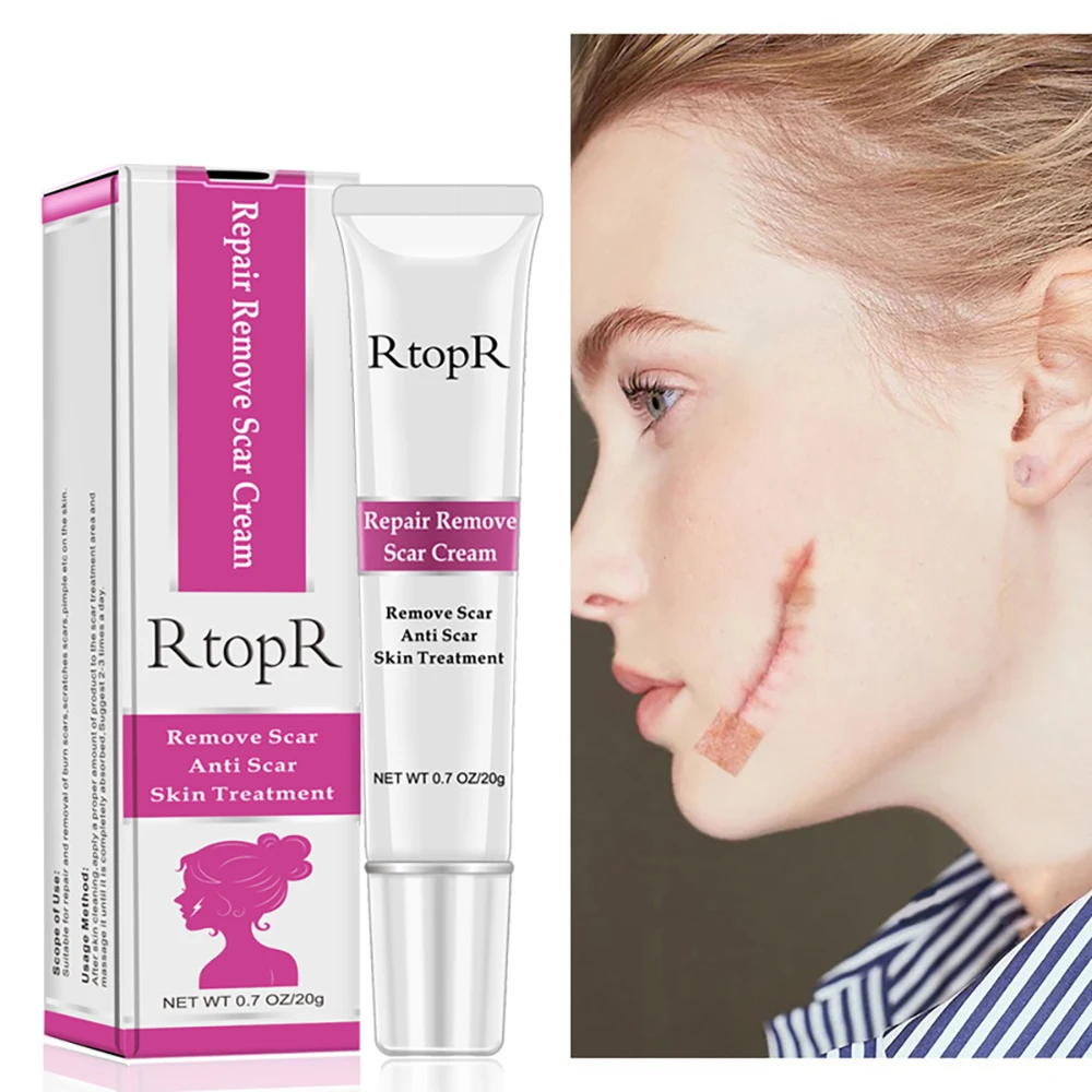 

Natural plant anti scar skin repair deep scar removal cream