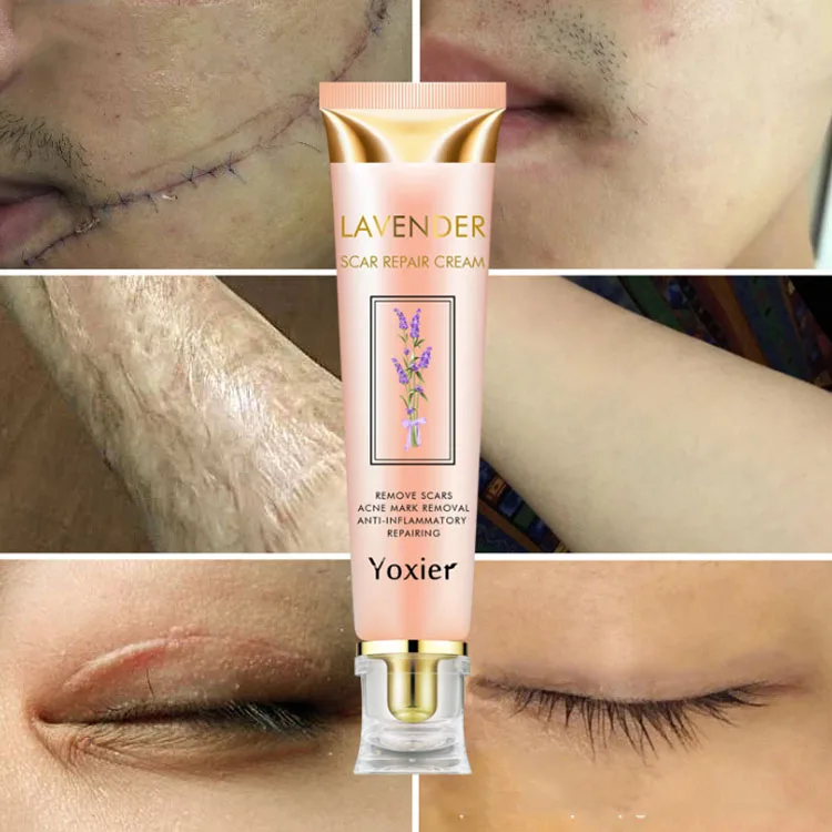 

Yoxier Anti Stretch Marks Cream Repair Stretch Marks Cream Scar Removal Cream, Rose gold