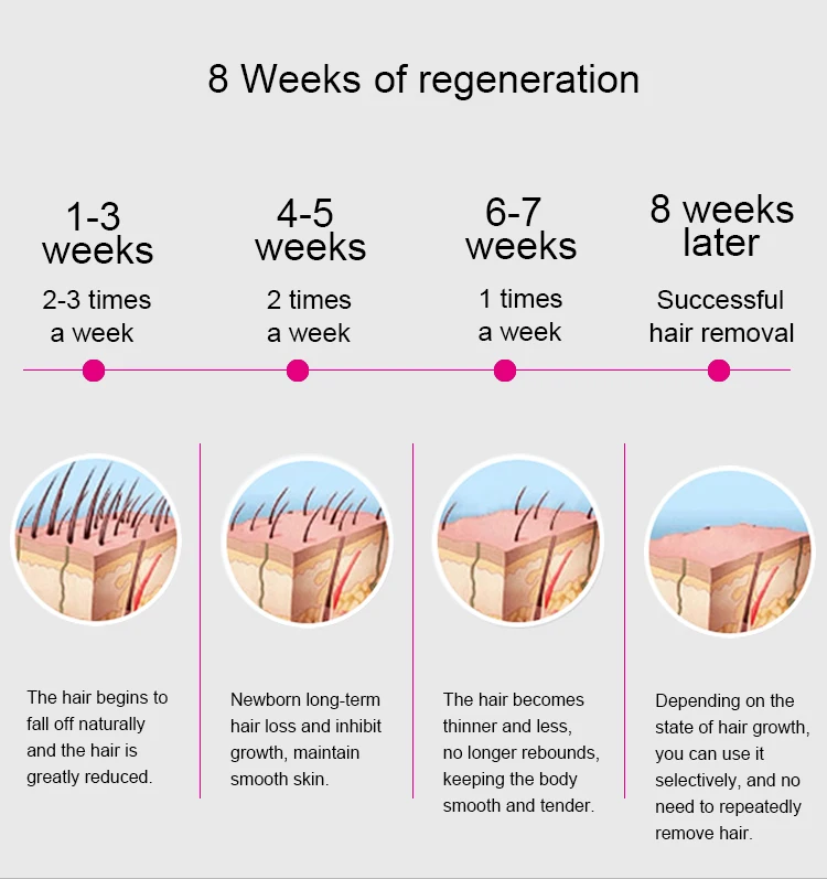 lazer hair removal machine
