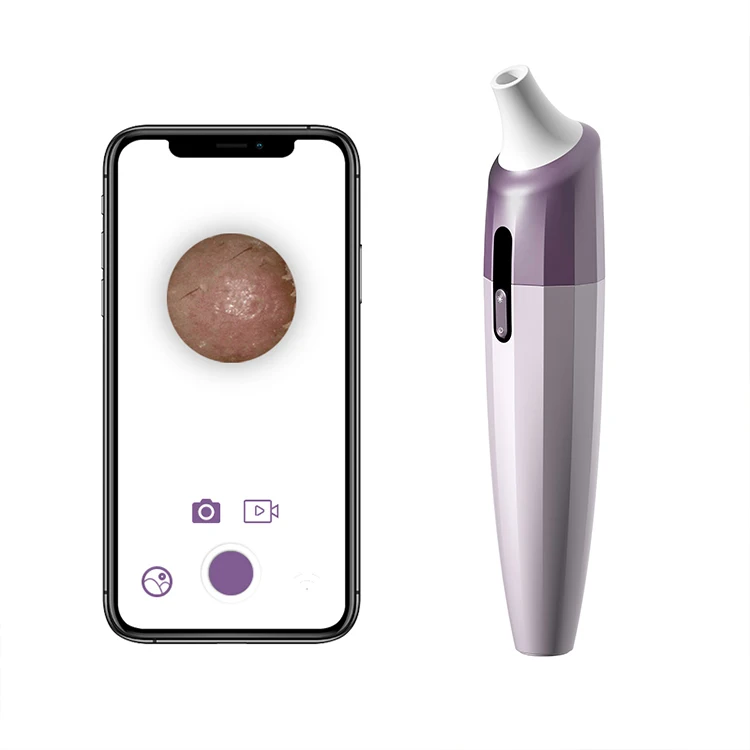 

HD Camera Wireless WiFi Connected App Visual Blackhead Pore Vacuum Cleaner Acne Grease Comedone Whitehead Remover Tools, White/customize