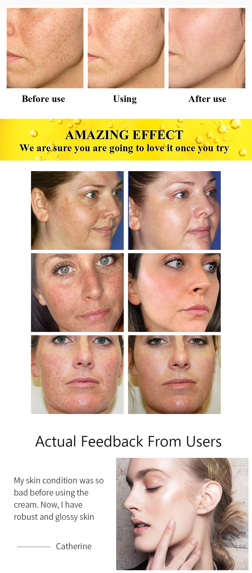 breylee vitamin c whitening cream