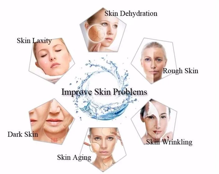 

2020 New Face Firming Hyaluronic Acid Skin Care facial dermal fillers macrolane injection filler ha filler for breast expansion
