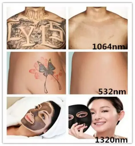 treatment