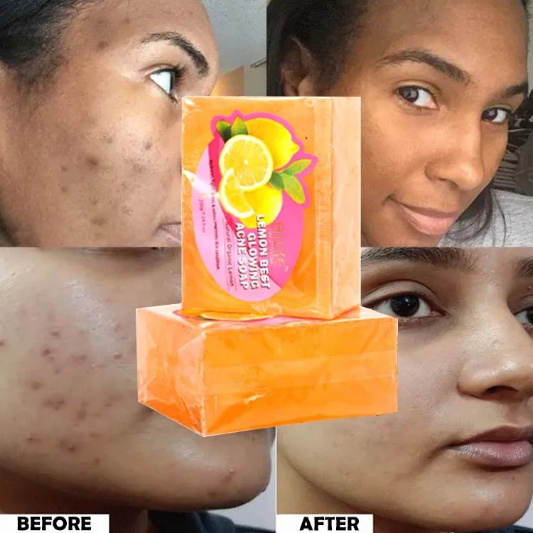 

Private Label Brands Acne Face Skin Whitening Natural Lemon Hand Wash Handmade Soap For Men And Women