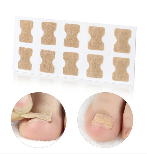 

Pedicure Nails Care Ingrown Toe nail Correctors, Any color