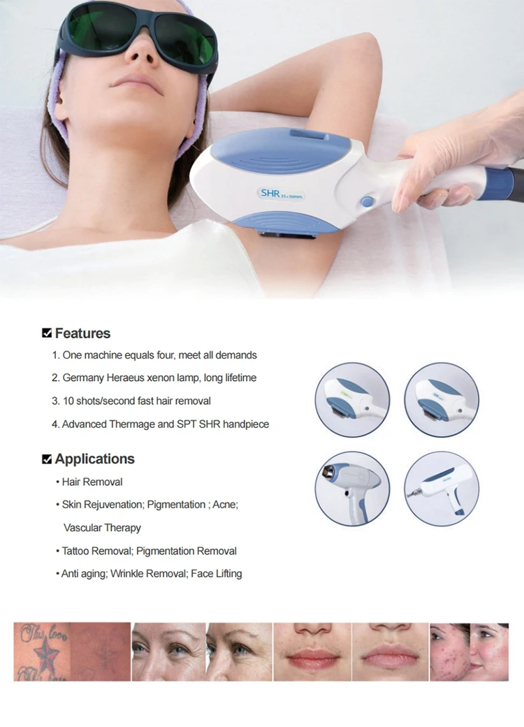 best selling products elight ipl rf beauty equipment / e-light ipl rf+nd yag laser multifunction machine ipl china