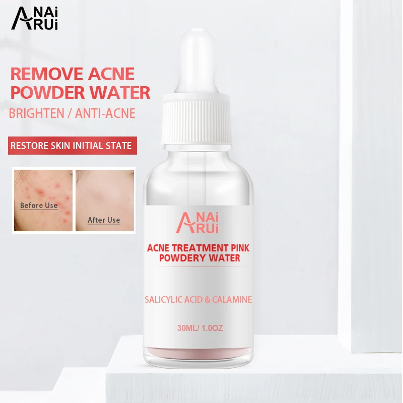 

Hot selling Treatments acne scar removal acne cream Beauty drying lotion acne skin care serum