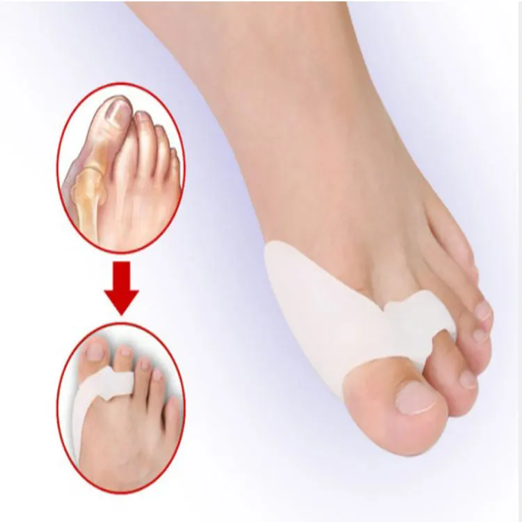 

Hallux Valgus Big Toe Corrector Bone Orthotics Braces Bunion Orthopedic Thumb, Transparent or white