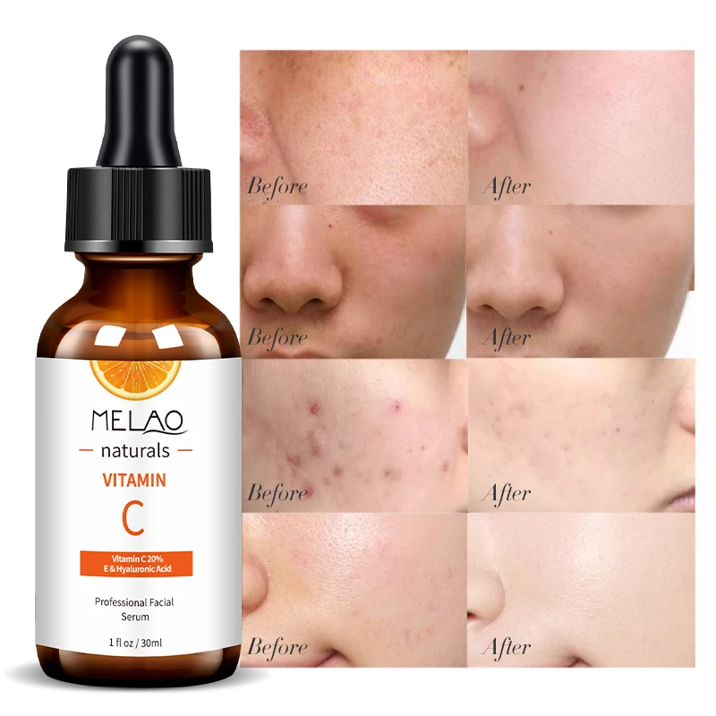 

Private Label OEM/ODM Melao Organic Vc Deep Moisturizing Anti Aging Whitening Skin Care 30ml Facial Vitamin C Face Serum