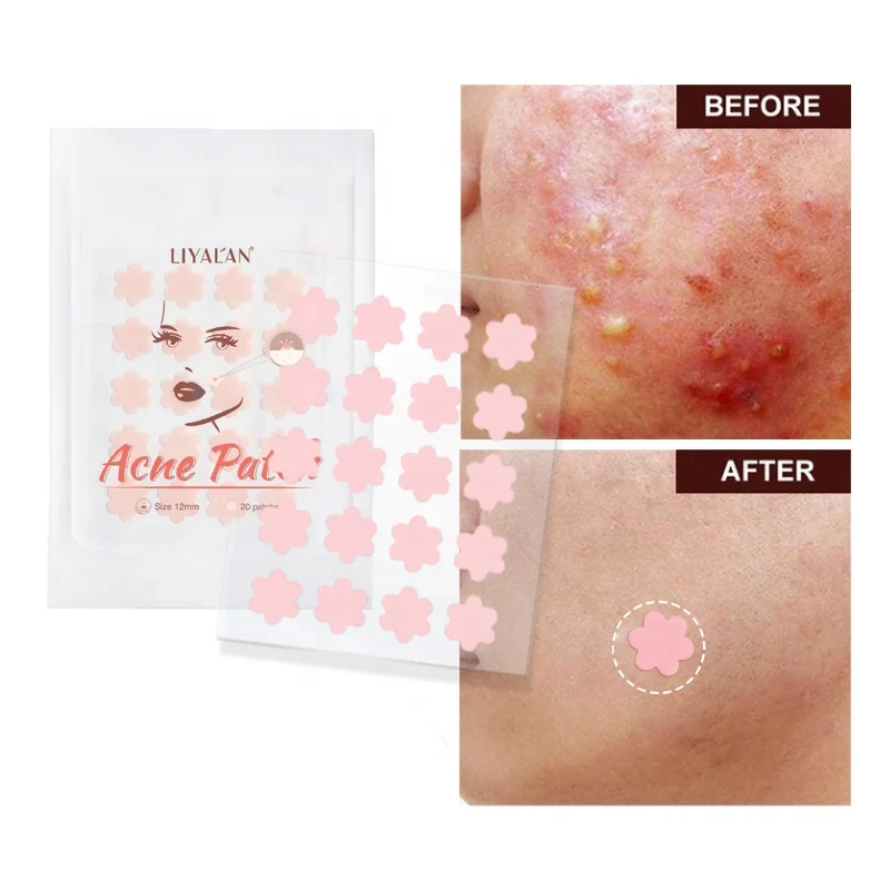 

Custom Private Label Acne Treatment Acne Plaster Pimple Master Patch Hydrocolloid Acne Patch