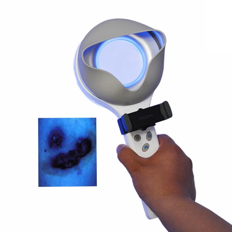 

Kernel KN-9000B portable dermatology LED Woods Lamp medical magnifier skin analyzer