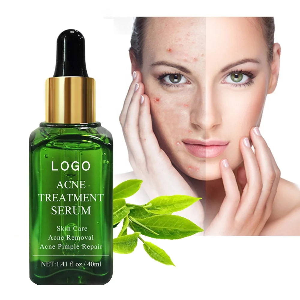 

Teatree Serum Herbal Acne Treatment Anti Acne Repair Scar Removal Acne Serum Face Serum