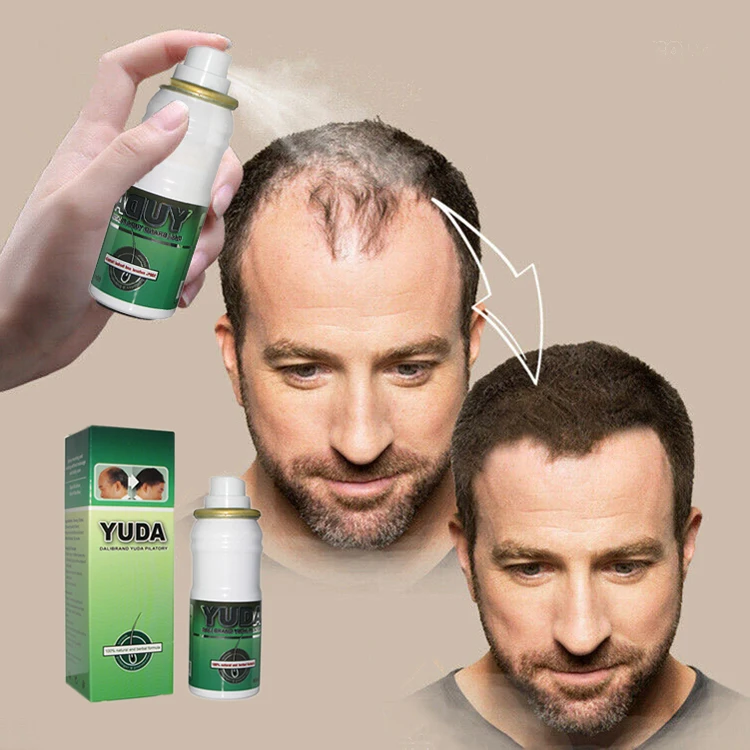 

Pure Herbal Hottest Sale Natural Fast Hair Regrowth for Hair Loss