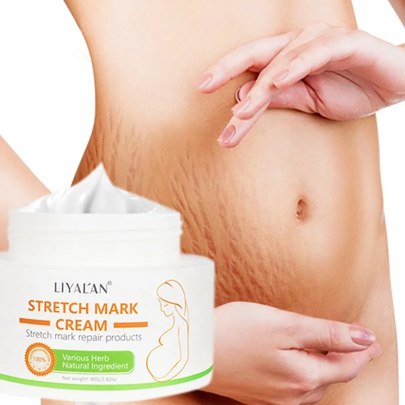 

Stretchmark Repair Scar Cream Pregnancy Abdomen Anti Vergeture Organic Shea Butter Stretch Mark Removal Cream For Arm