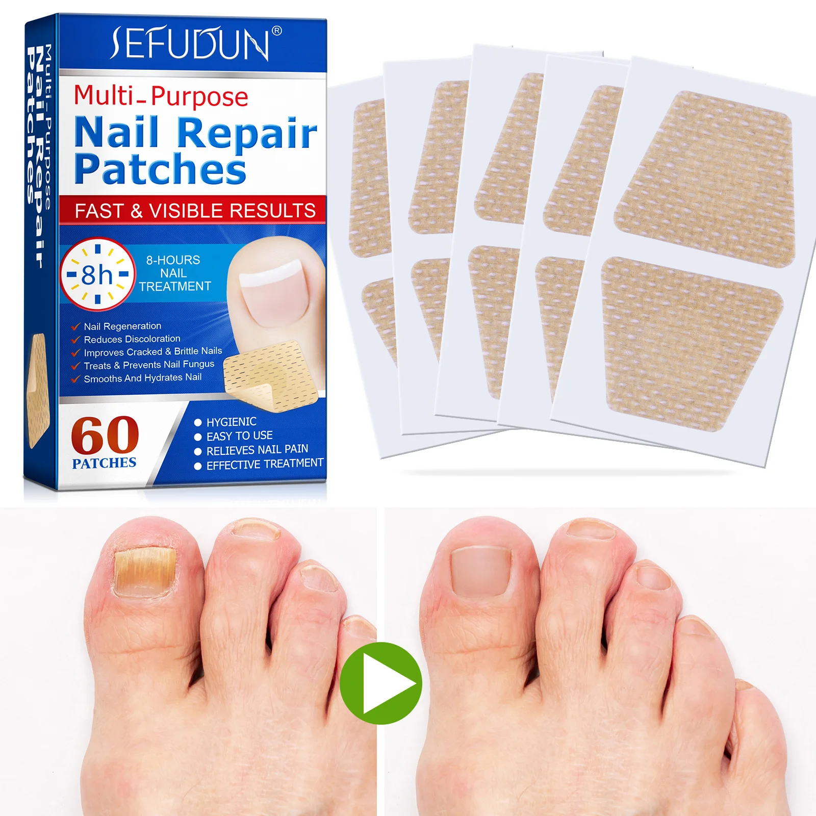 

nail treatment patch anti fungal nail correction stickers ingrown toenail care paronychia anti infection nail repair patch