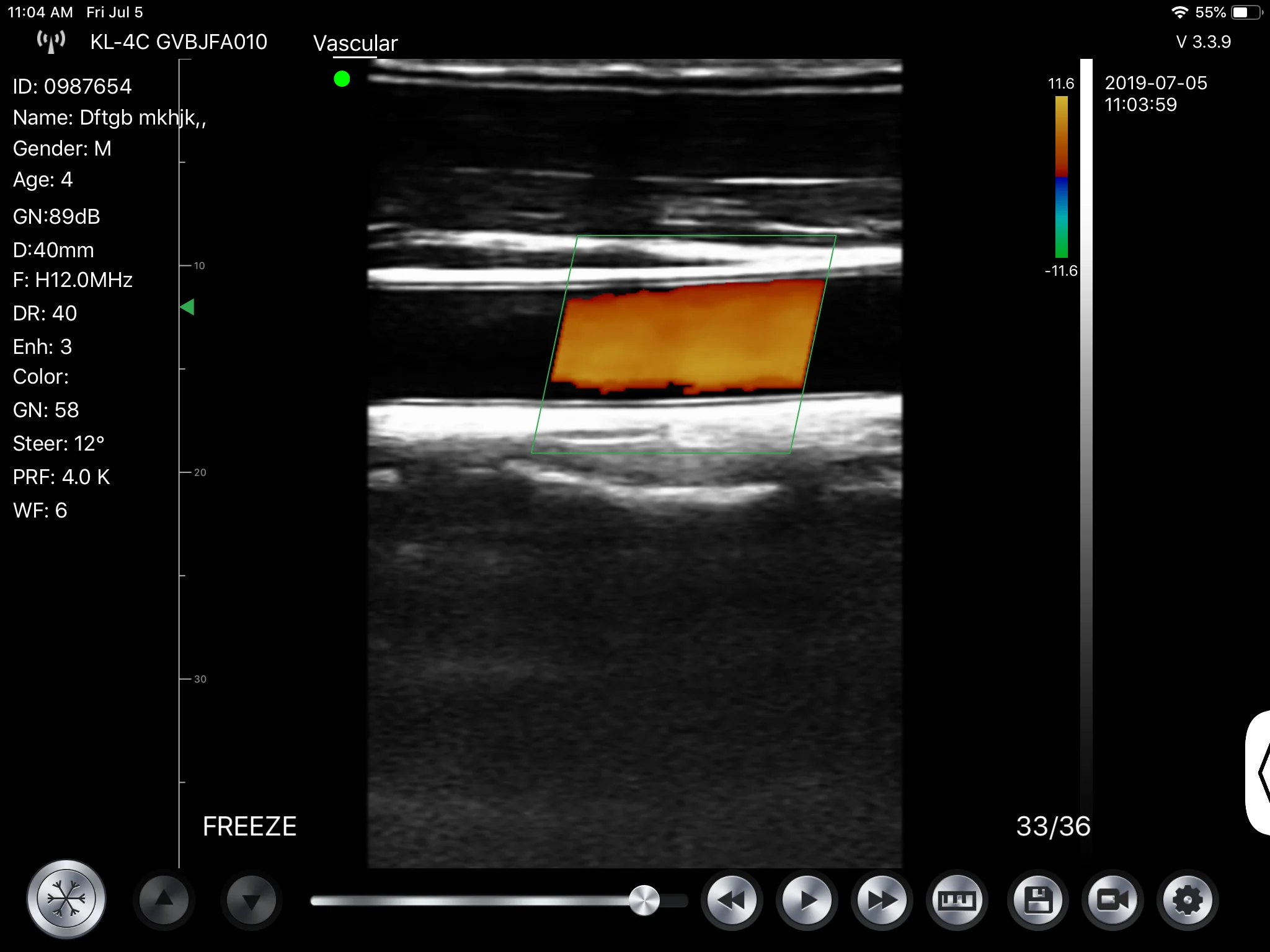 
2019 Konted digital portable wireless ultrasound 10/12MHz linear probe Gen4pro for clinical emergency 