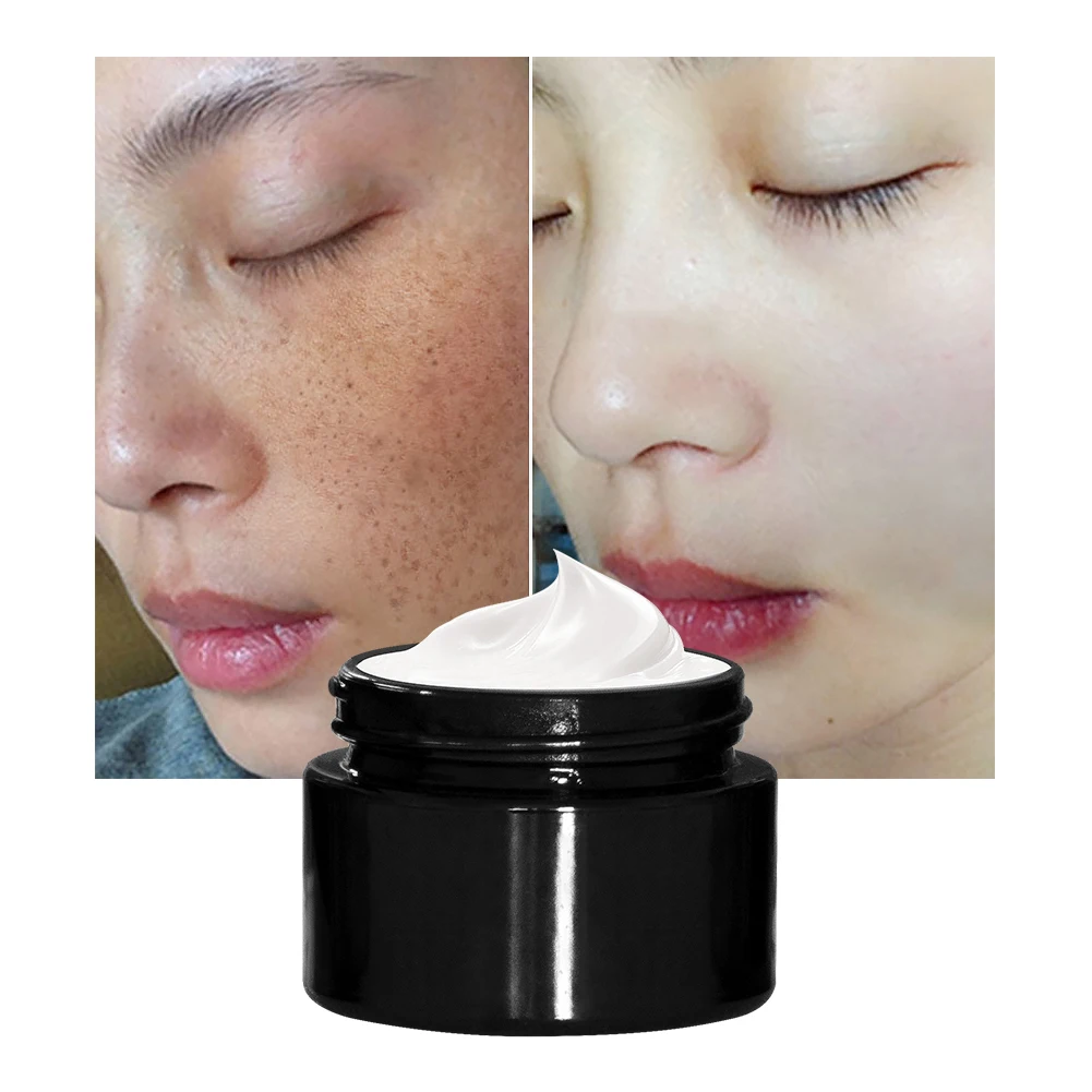 

Private label moisturizer herbal cream acne cream for skin care cellulite cream