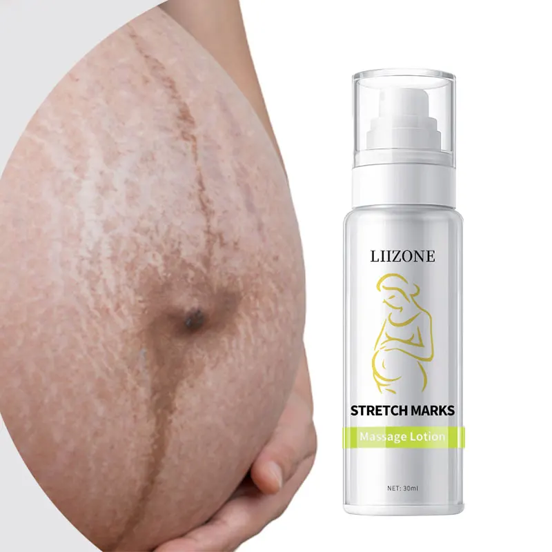 

LIIZONE Cocoa Butter Formula Massage Cream for Stretch Marks and Pregnancy Skin Care Ideal Pregnancy Belly Cream