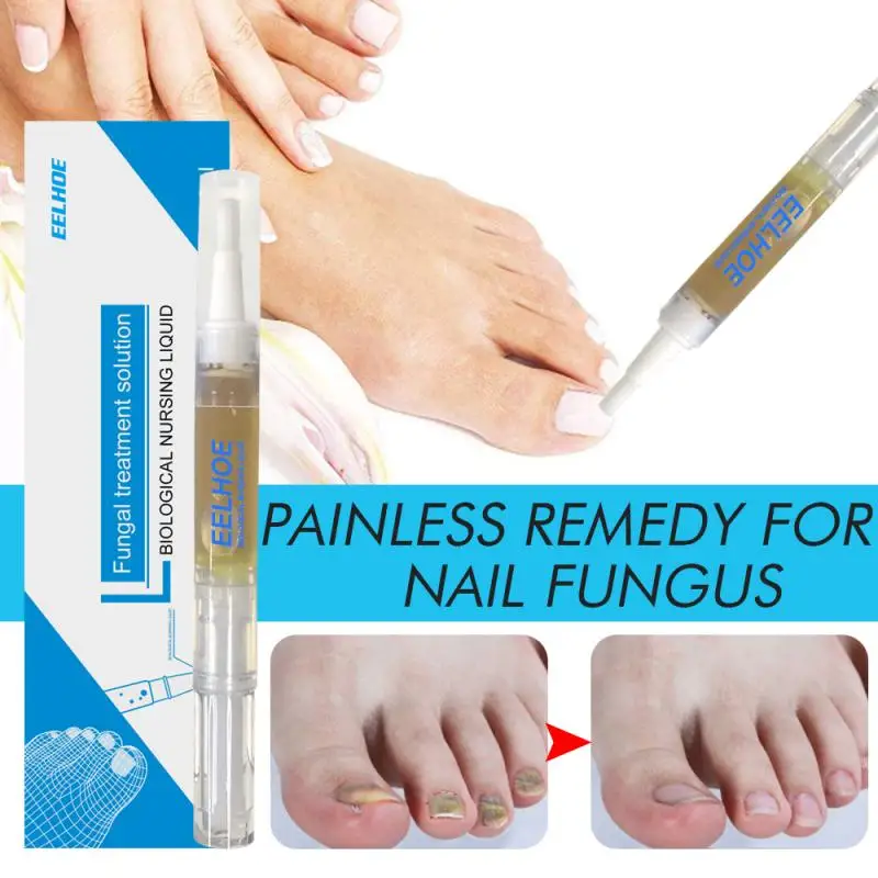 

Herbal Nail Fungus Treatment Pen Nail Treatment Pen Onychomycosis Paronychia Anti Fungal dropshipping