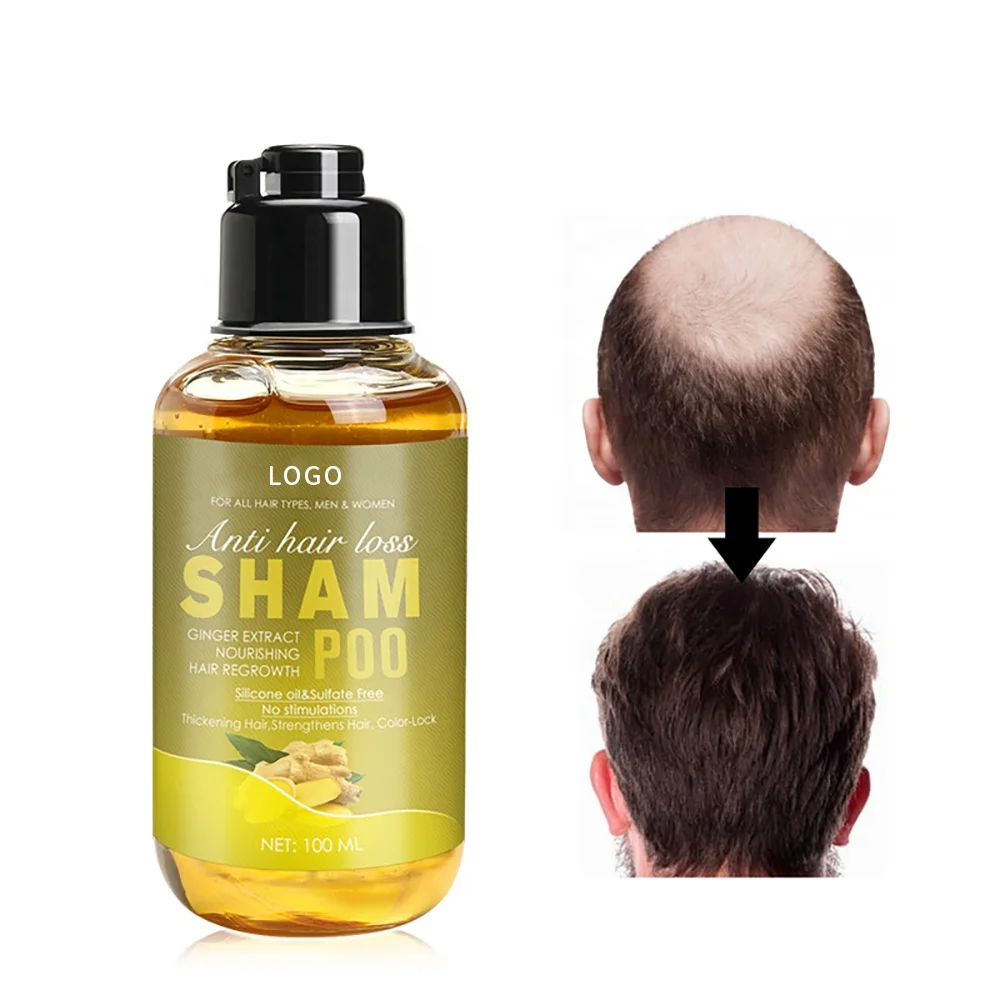 

Herbal Organic Anti hair Loss Shampoo Dandruff Natural Organic Hair Growth Ginger Shampoo