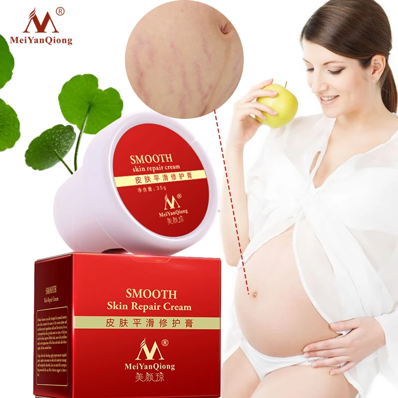 

Maternity treatment Body Skin Care Postpartum Removal Scar Stretch Mark Cream