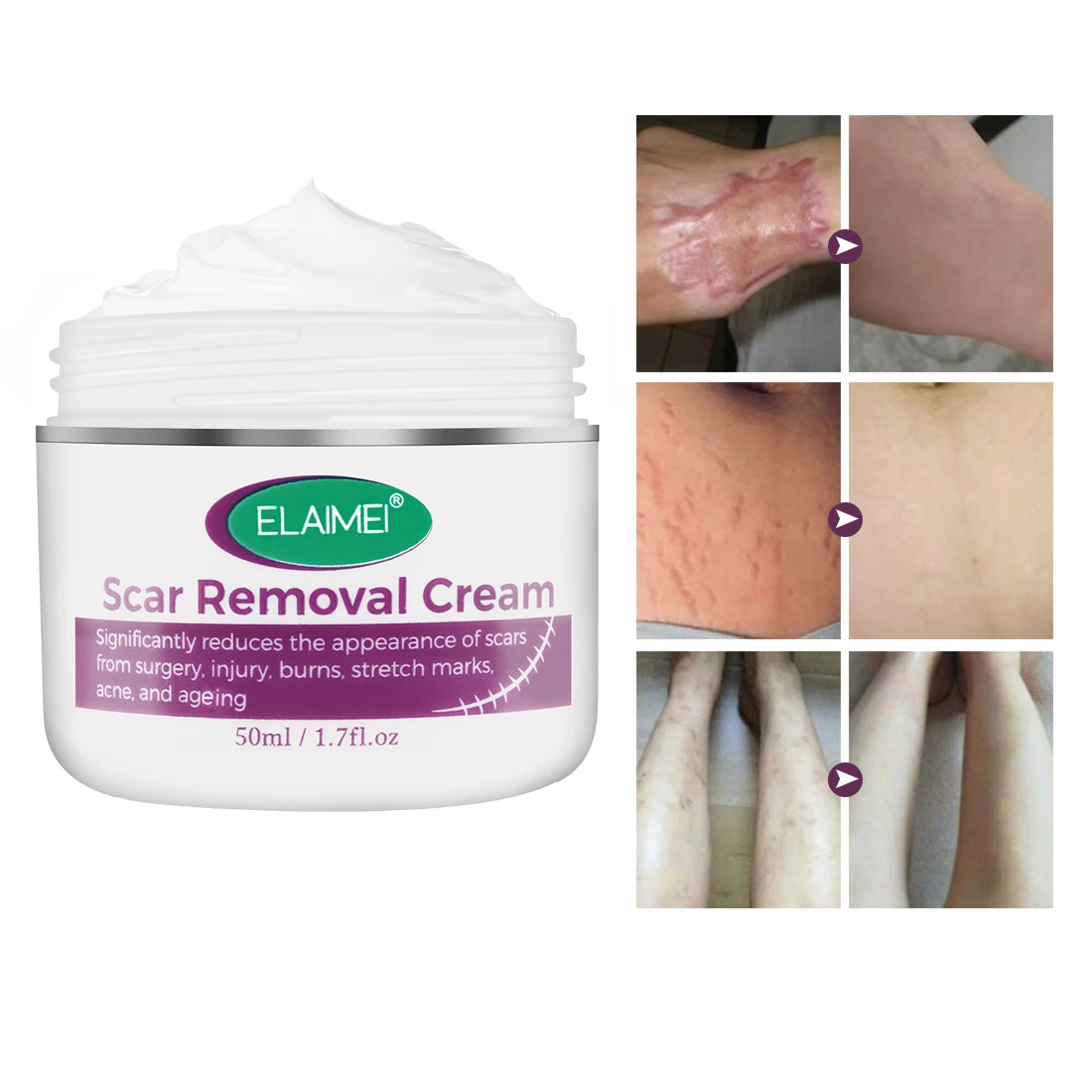 

ELAIMEI Natural Herbal Skin Repair Acne Pimple Mark Stretch Marks Treatment Face Scar Removal Cream