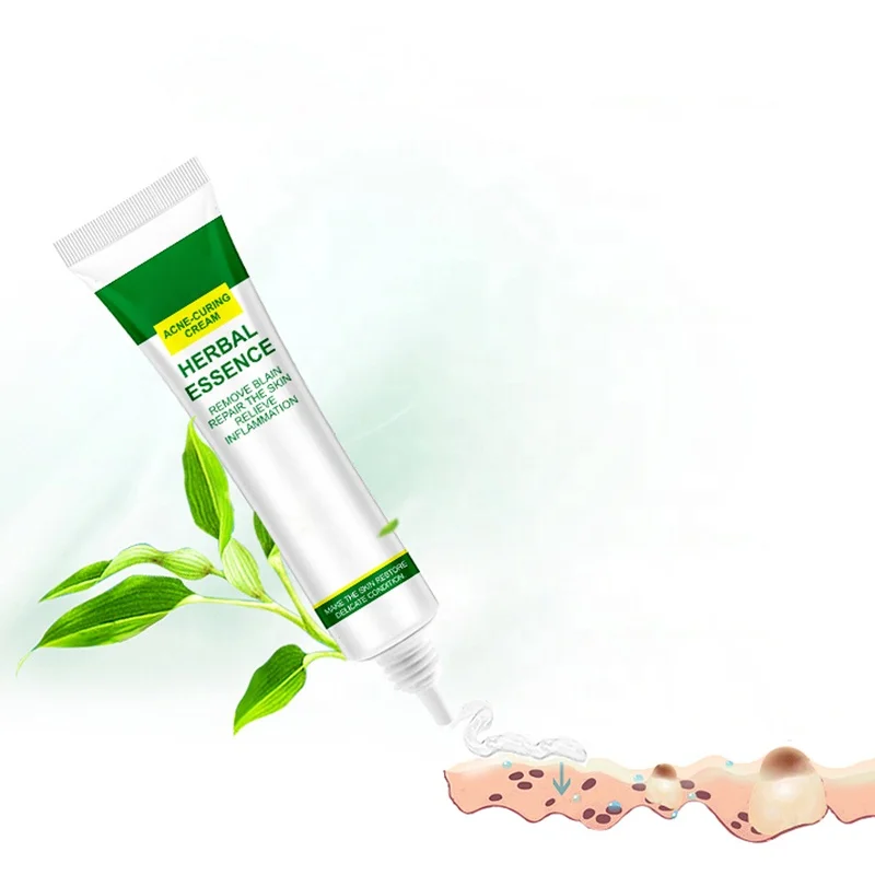 

Facial anti acne and whitening cream Spot Treatment Products Pimple Acne Scar Treatment Removal for sensitive skin