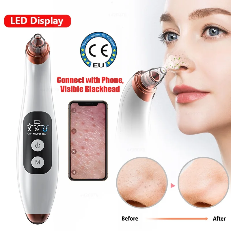 

2021 Beauty Facial Best Selling Product Comedo Acne Pore Cleaner Blackhead Suction Remover Extractor Vacuum for Deep Clean