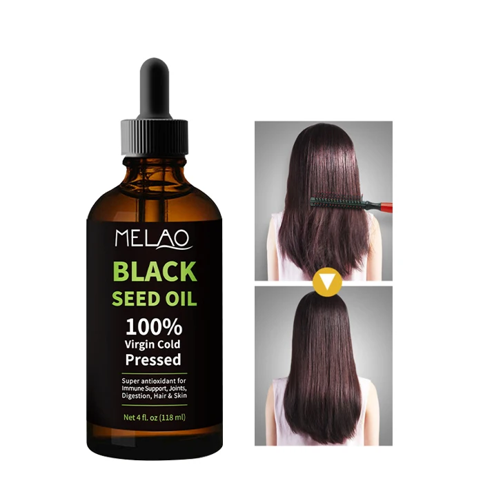 

Wholesale 100% Organic Pure Cold Pressed Black Seed Essential Oil