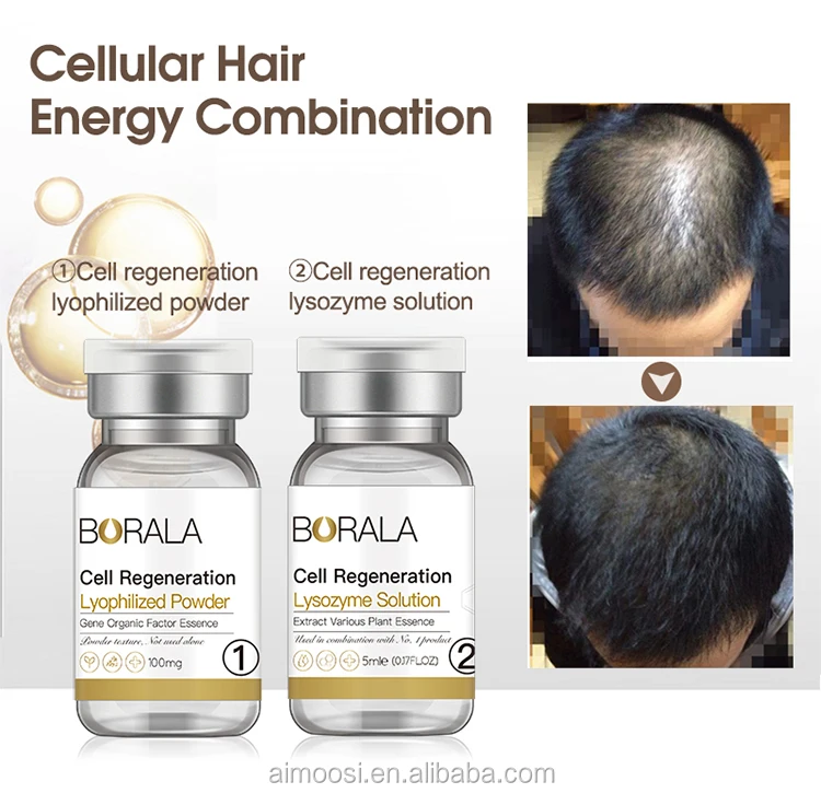 World Best Herbal Hair Regrowth Product Fast Hair Growth Essence Serum