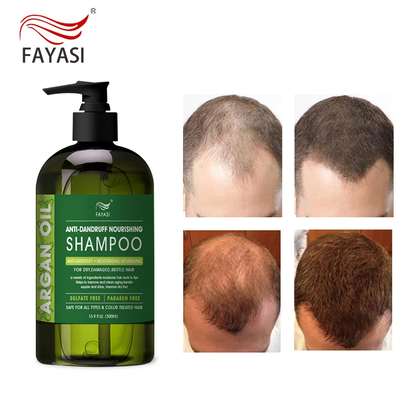 

Best selling quality hair darkening shampoo for NET/OA/AMS 30 days