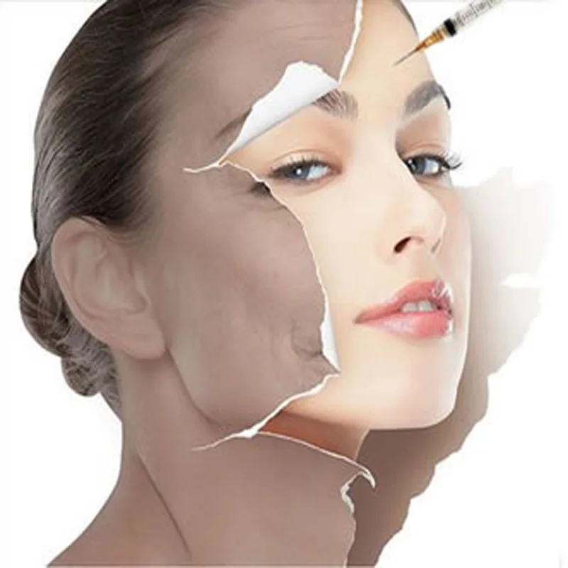 

Whole Sale Made in Korea Cross-Linked Hyaluronic Acid Gel Injection Dermal Filler
