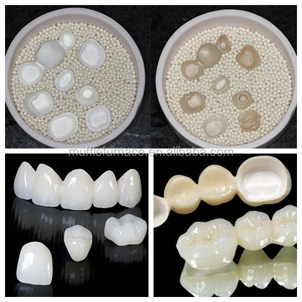 dentures.jpg