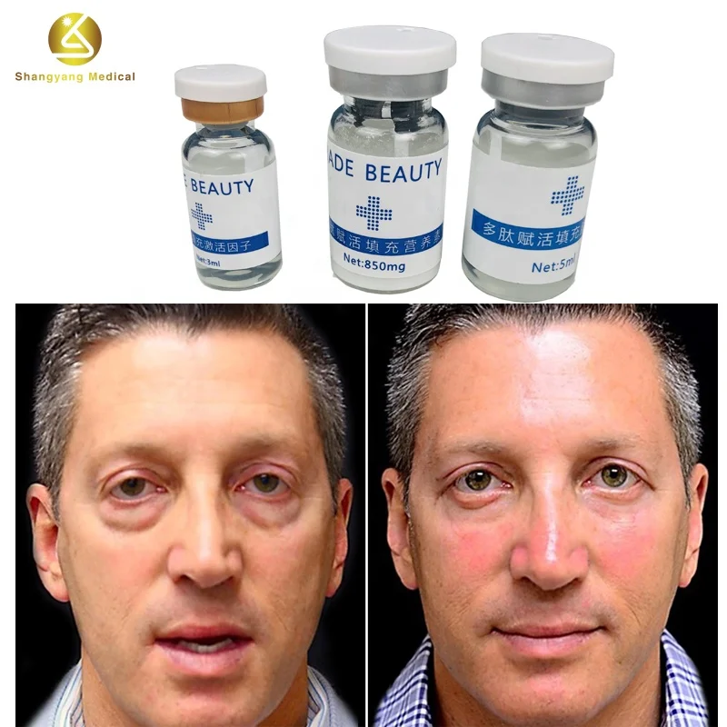 

Shangyang Best eye bag remove bag removal good quality