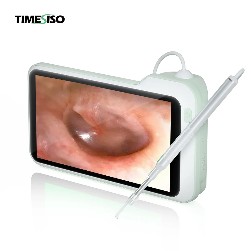 

4.3 Inch Display Screen Earwax Cleaning Tool Digital Ear Otoscope with 6 LED Ear Inspection Camera 3.9mm Ear Endoscope