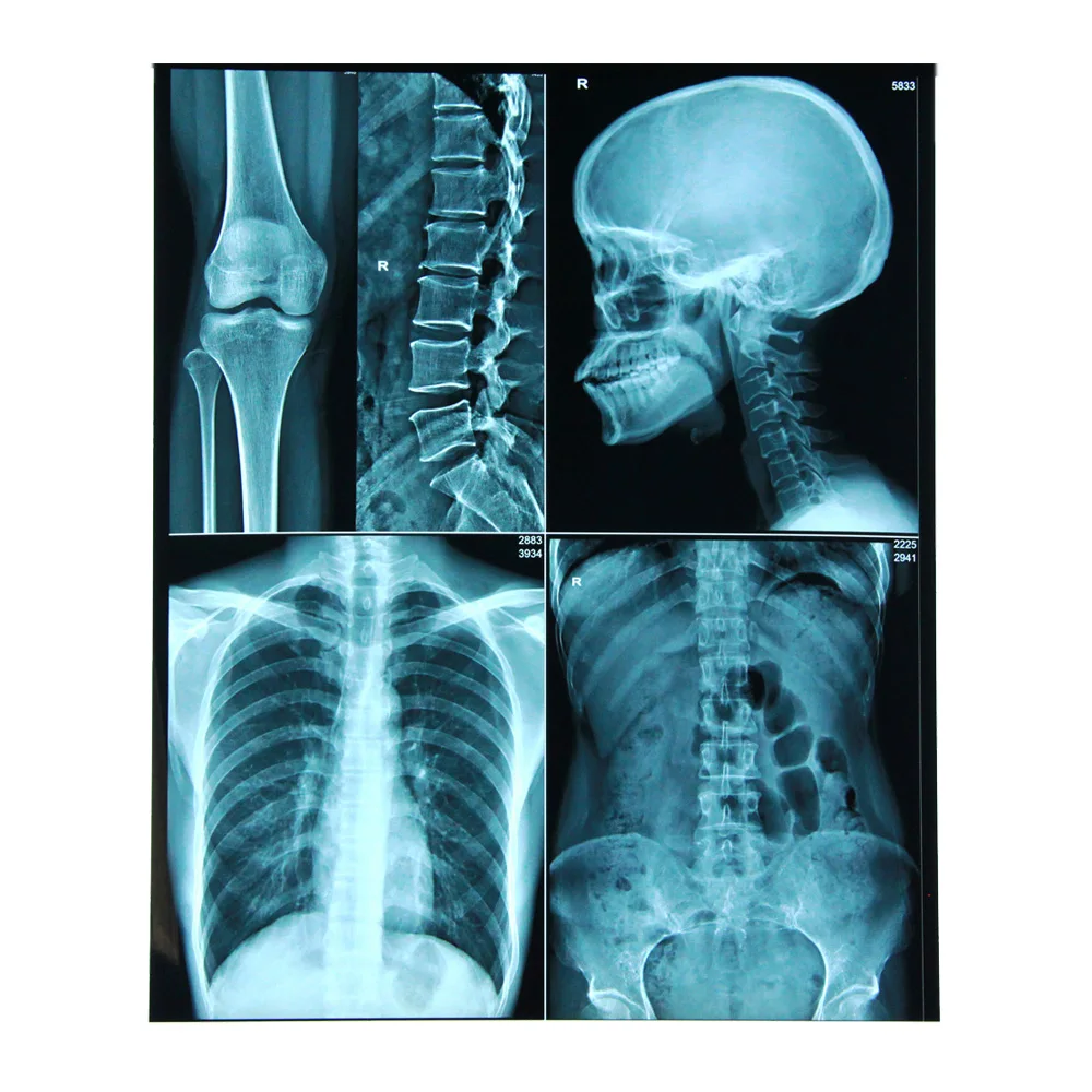 
PET based blue Fuji medical x-ray film laser X-Ray film 