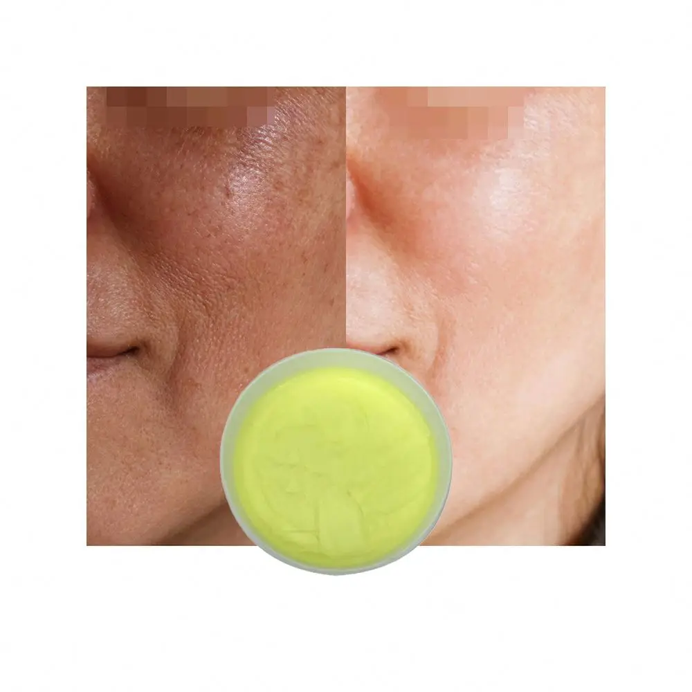 

High Quality Korean Anti Freckle Whitening Cream For The Whole Body Intimate Parts 50G semi-finished Base Sold by Weight