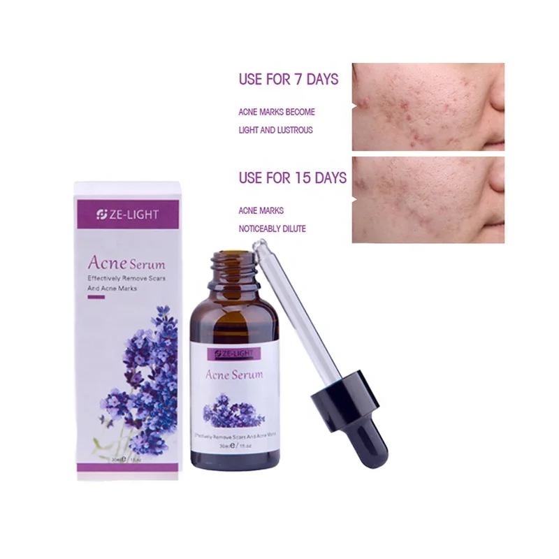 

Lavender Organic Anti Acne Dark Spot Removing Moisturizing Oem Cosmetic Repairing Face dark spot corrector serum, Transparent